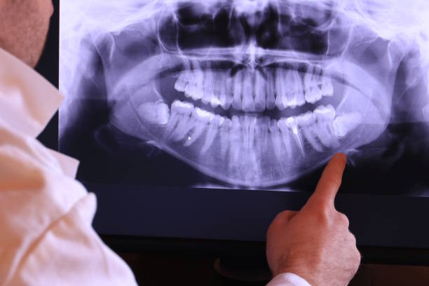 Best Emergency Root Canal Treatment in Troy, TN