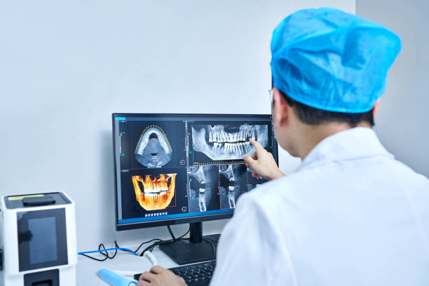 Best Emergency Wisdom Teeth Removal in Troy, TN