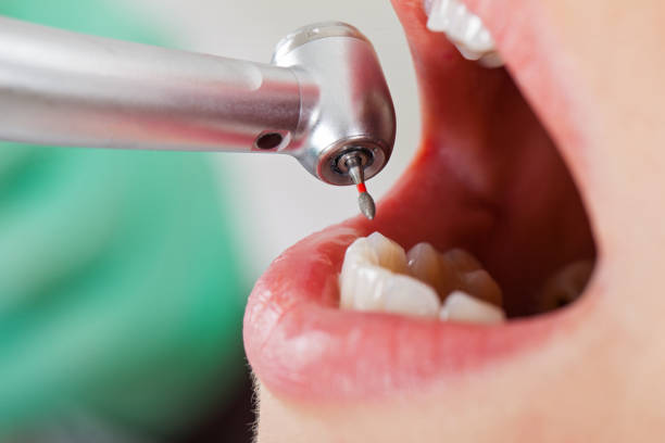 Best Emergency Dental Surgery in Troy, TN